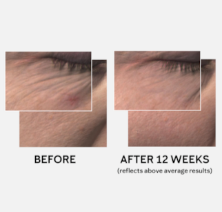 TimeWise Miracle Set 3D Combination-to-Oily Skin.